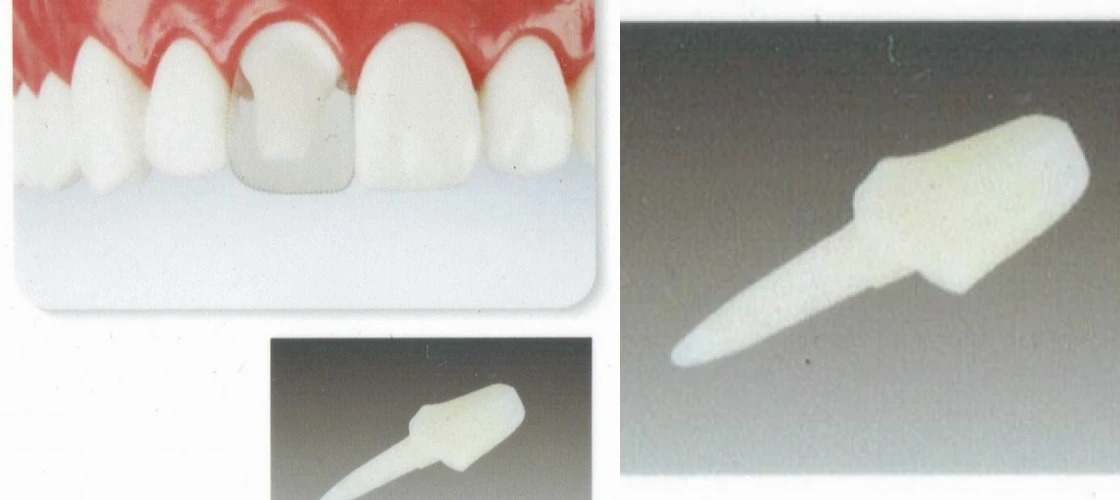 ファイバーコア